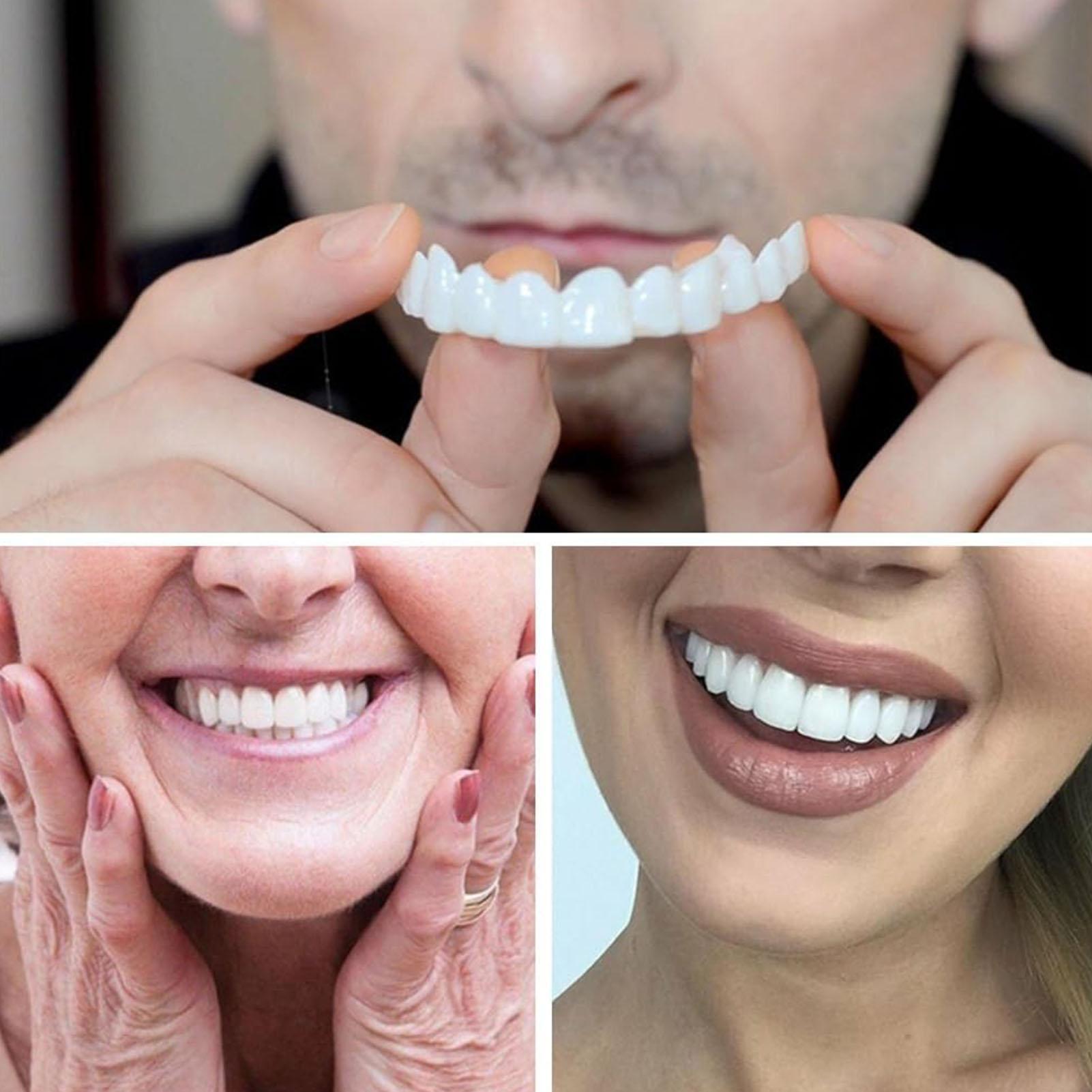 Teeth Whitening In Office - Kit de Dentes Postiços Snap-on, Dente