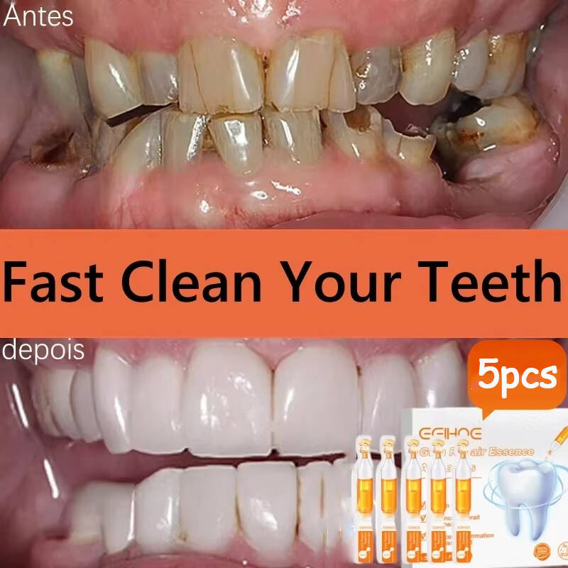 Teeth Whitening With Baking Soda - Soro de goma para reparação rápida,