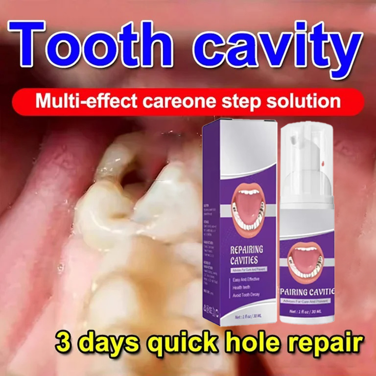 Teeth Whitening Treatment - Pasta de Dente para Limpeza Dental: