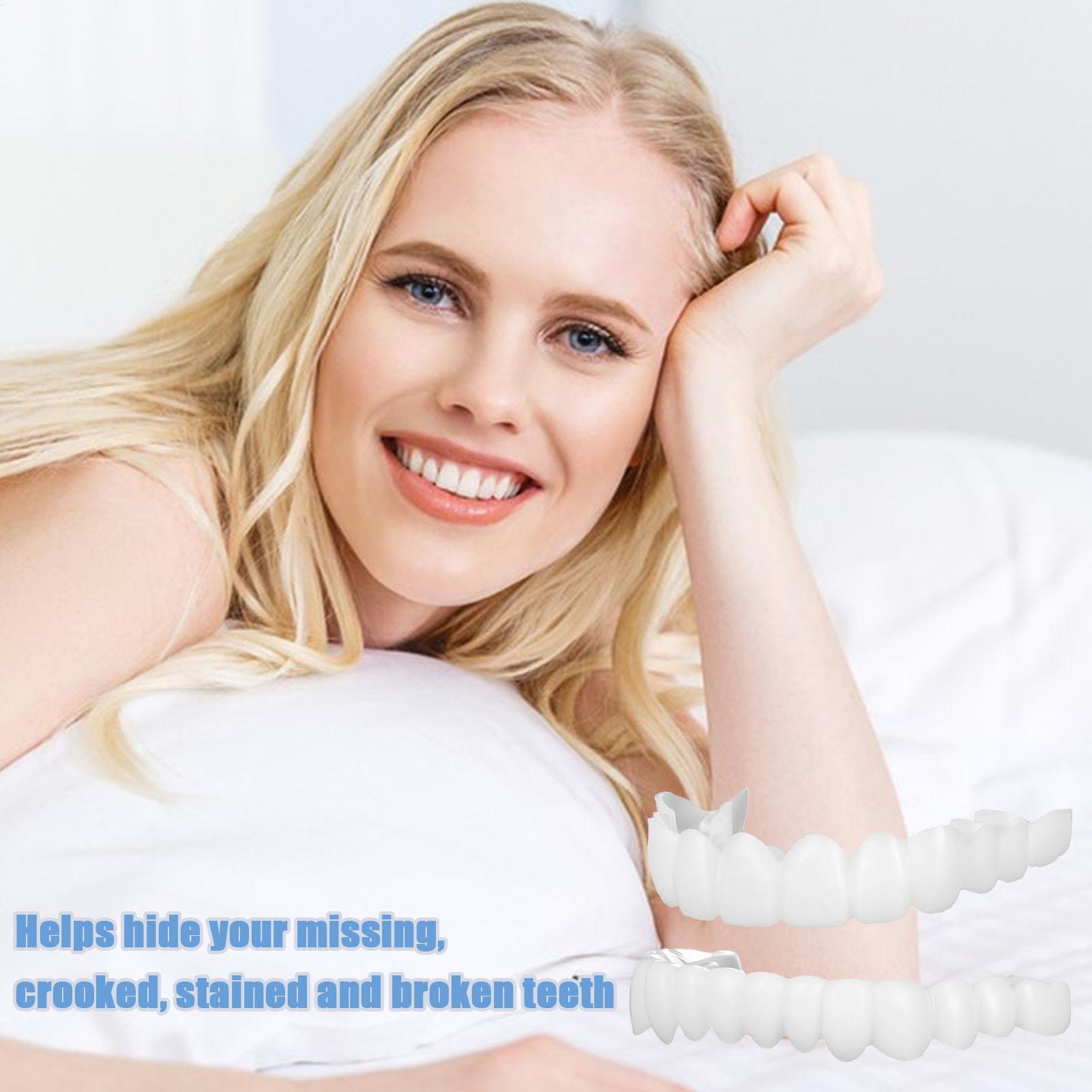 Kit de Dentes Postiços Snap-on - Teeth Whitening In Office avaliação e preço