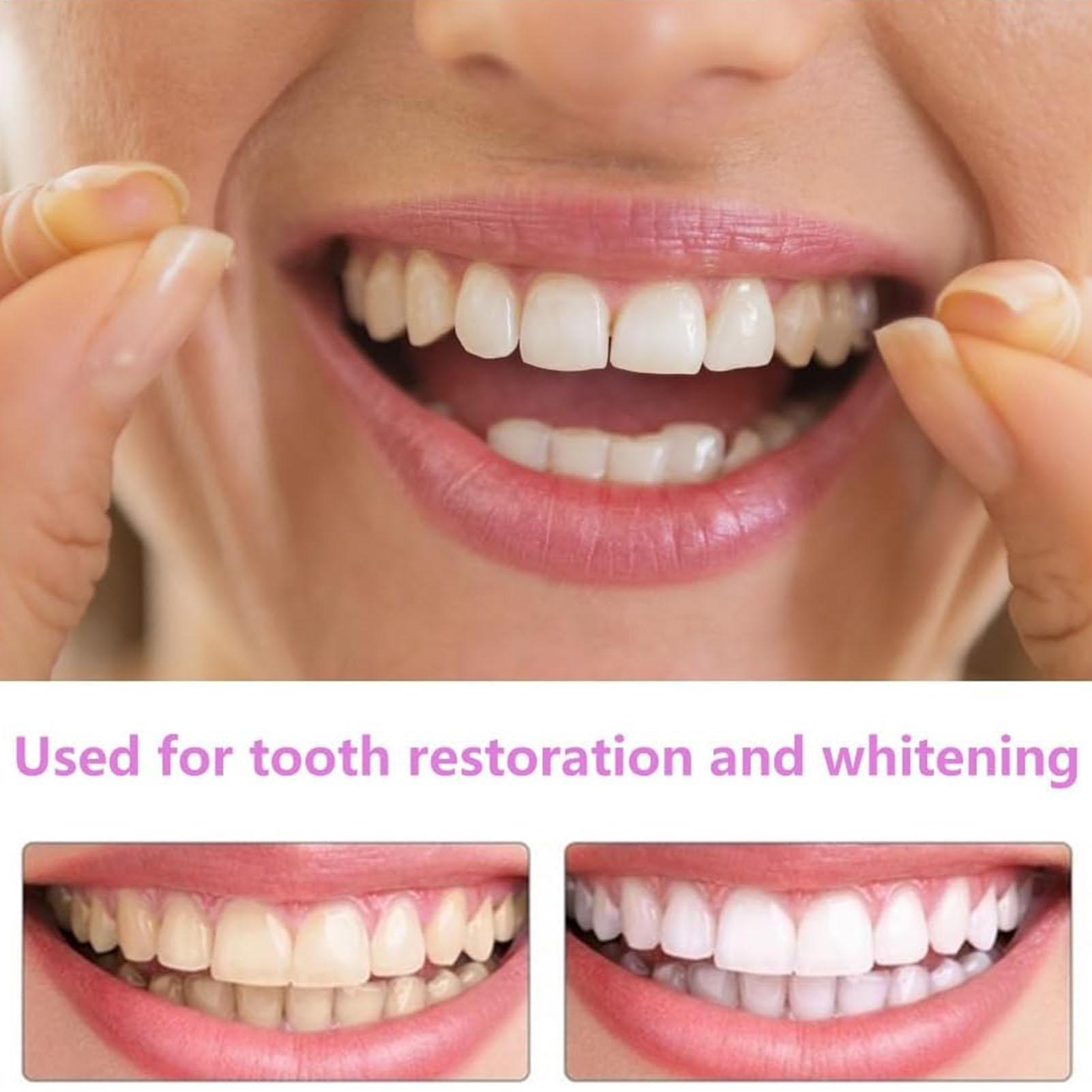 Kit de Dentes Postiços Snap-on - Teeth Whitening In Office avaliação e preço