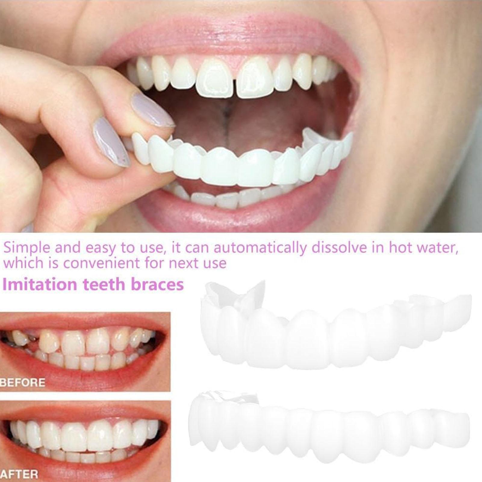 Kit de Dentes Postiços Snap-on - Teeth Whitening In Office avaliação e preço