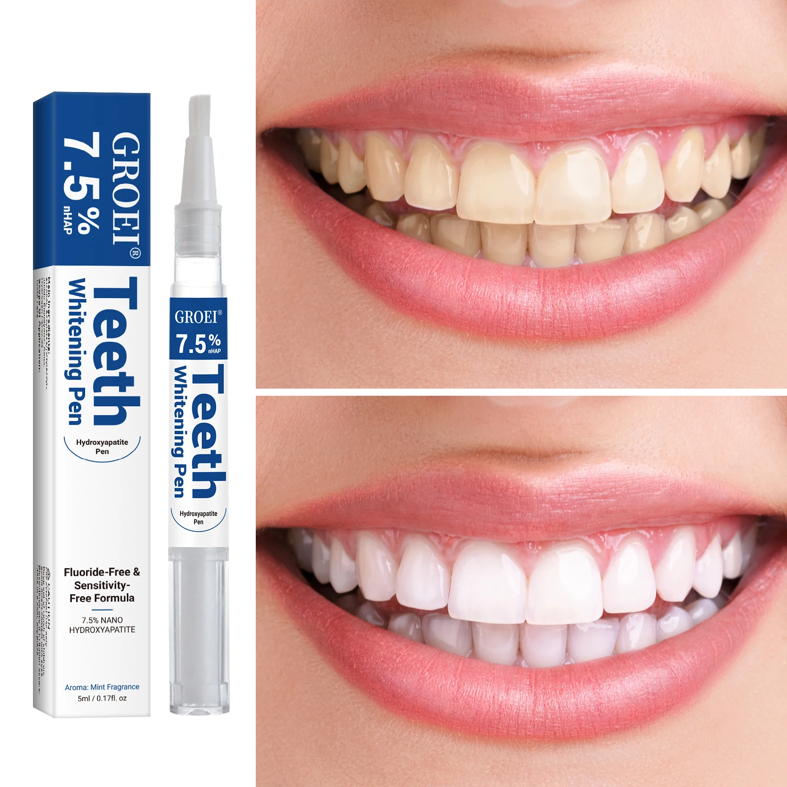 Caneta branqueadora de dente h - Teeth Whitening Q&M avaliação e preço