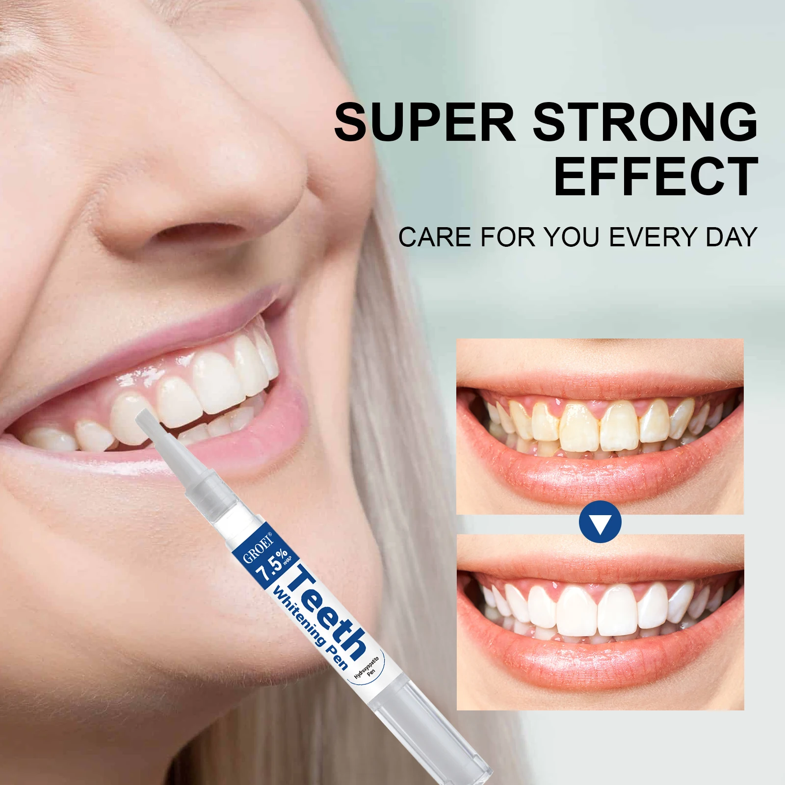 Caneta branqueadora de dente h - Teeth Whitening Q&M avaliação e preço