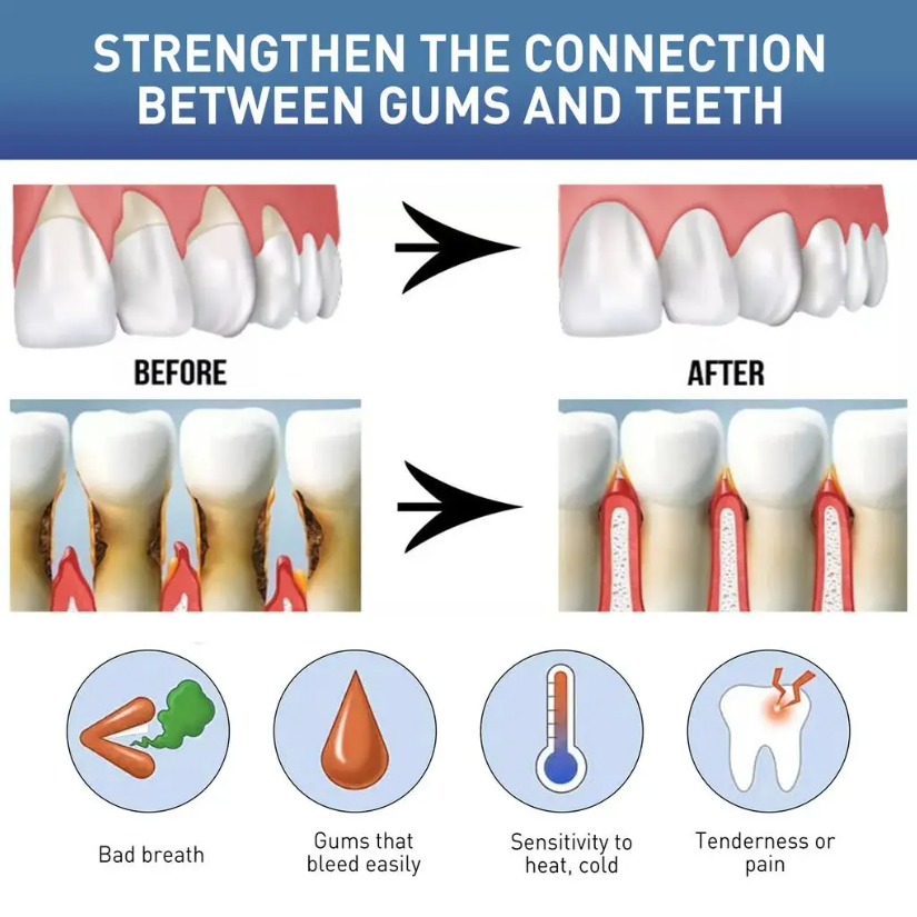 Líquido Natural para Cuidado O - Teeth Whitening Naturally avaliação e preço