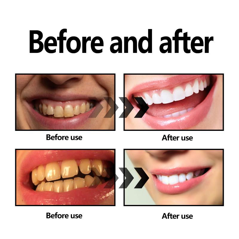 Esquivo dental em pó carvão/so - Teeth Whitening With Baking Soda avaliação e preço