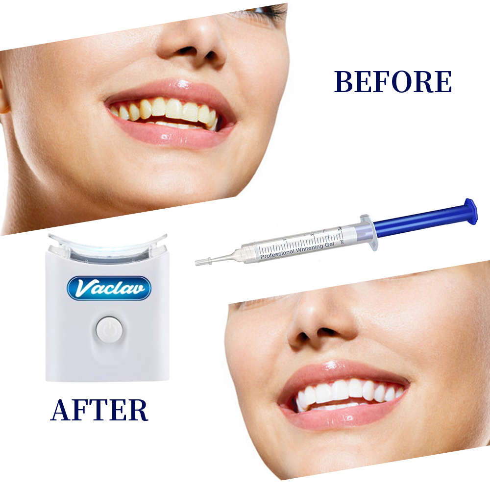 Seringa de gel para clareament - Teeth Whitening With Baking Soda avaliação e preço