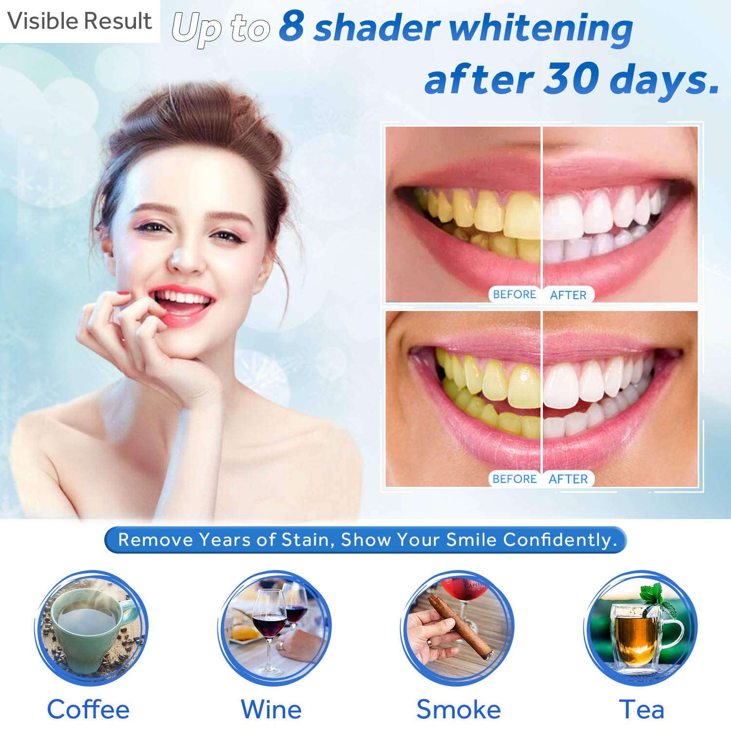 Seringa de recarga de gel para - Teeth Whitening Q&M avaliação e preço