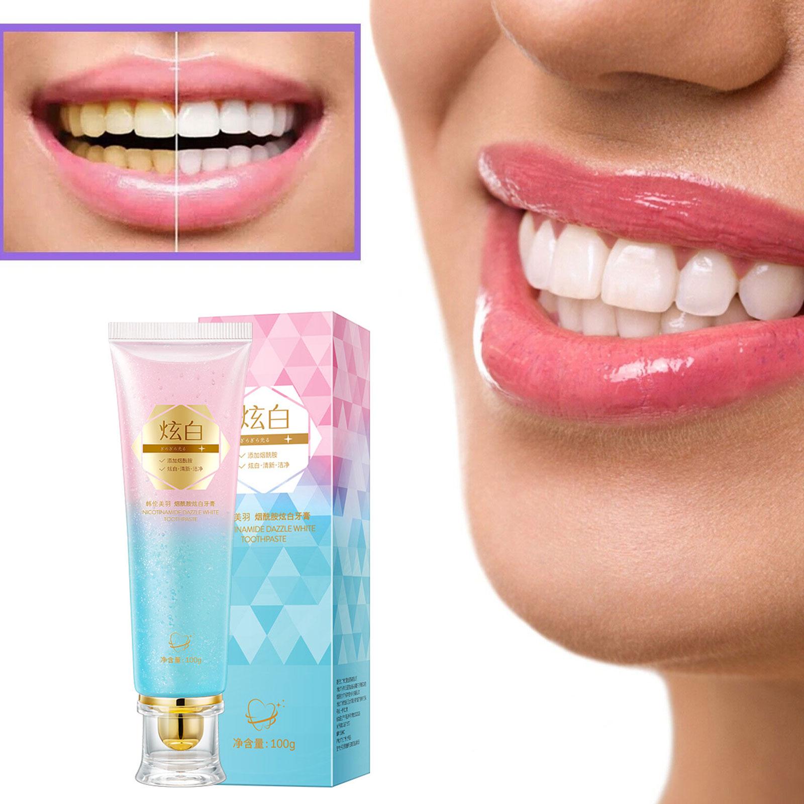 Niacinamida branqueamento crem - Teeth Whitening Treatment avaliação e preço