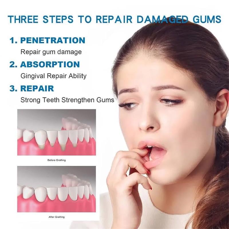 Sérum Reparador de Gengivas: A - Teeth Whitening Gingival Barrier avaliação e preço
