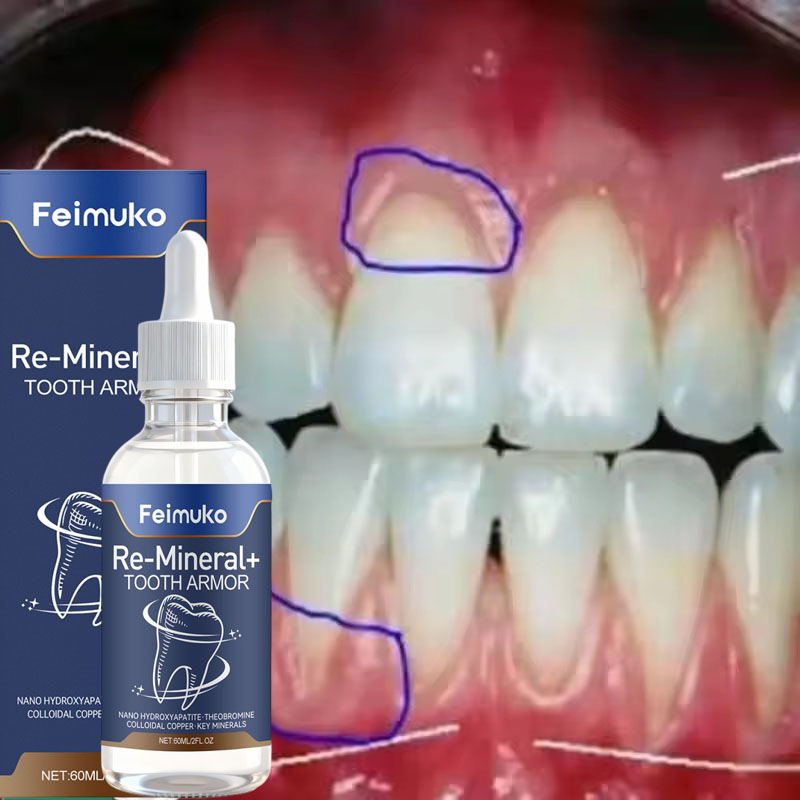 Sérum Reparador de Gengivas: A - Teeth Whitening Gingival Barrier avaliação e preço