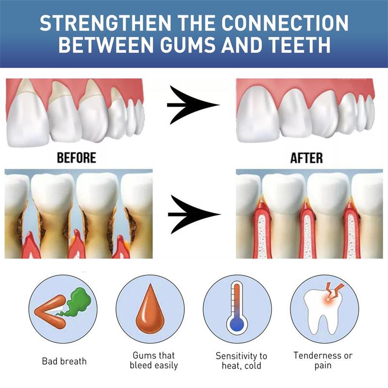 Sérum Reparador de Gengivas: A - Teeth Whitening Gingival Barrier avaliação e preço