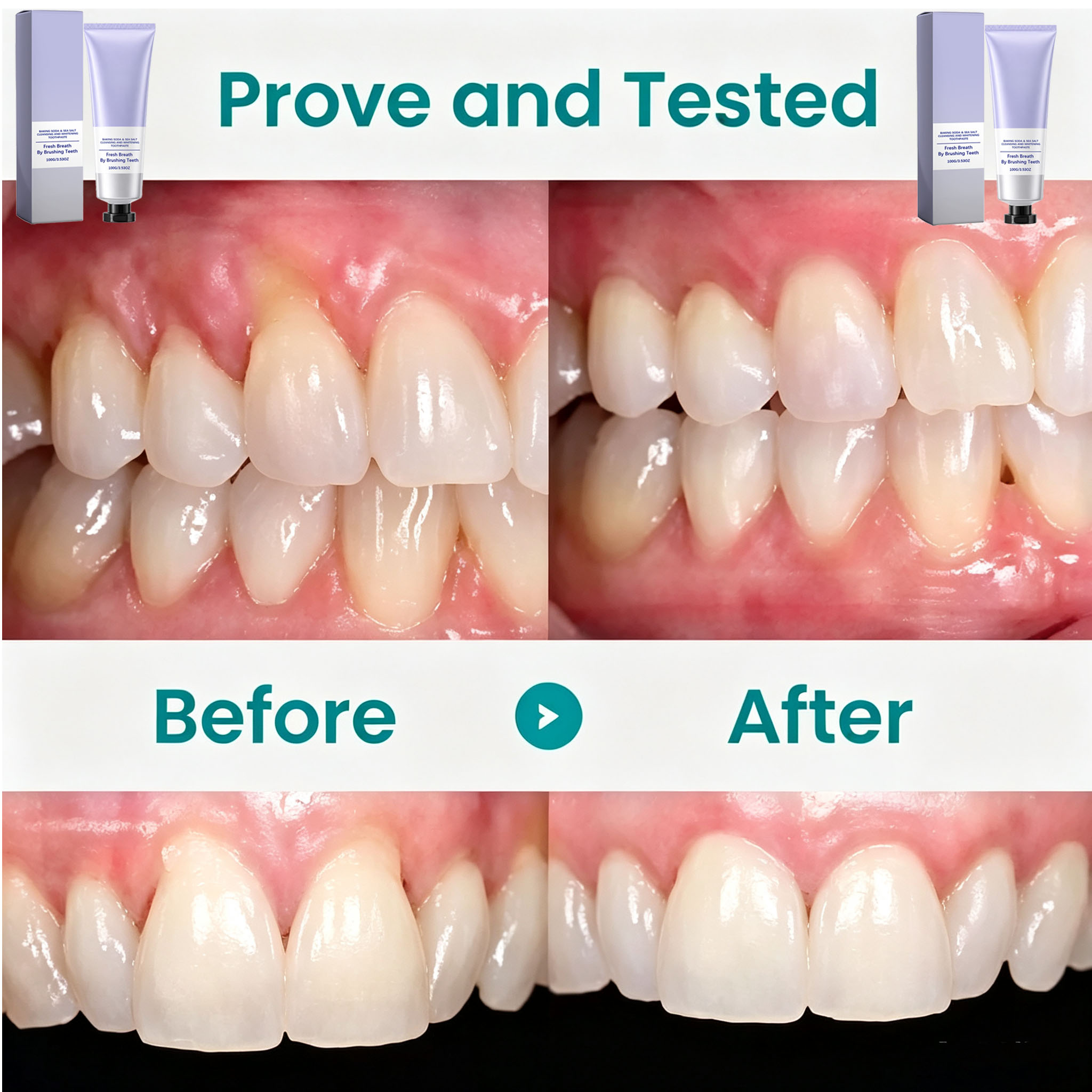 Pasta de Dente com Bicarbonato - Teeth Whitening With Baking Soda avaliação e preço