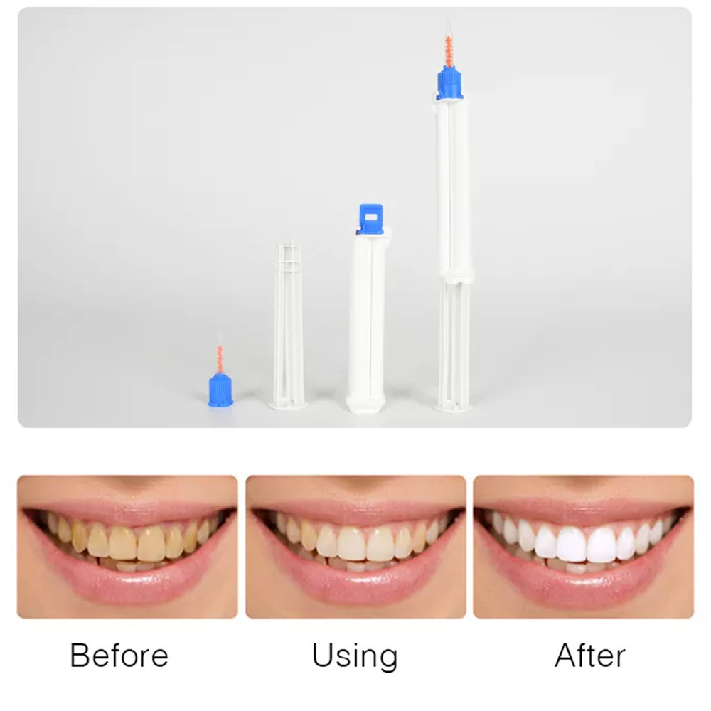 Seringa dentária de barril dup - Teeth Whitening Gingival Barrier avaliação e preço