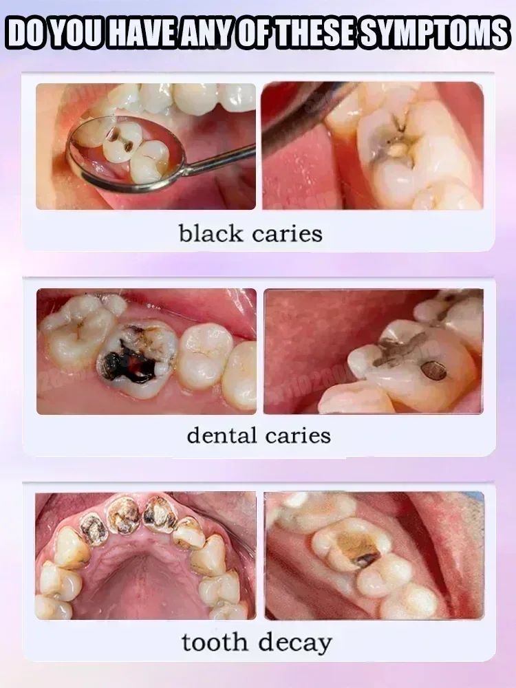 Pasta de Dente para Limpeza De - Teeth Whitening Treatment avaliação e preço
